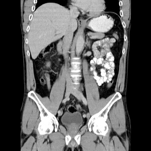 Dr J Veldman - CT Abdomen and Pelvis