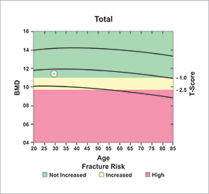 bone density test results bone density test results